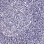 Immunohistochemical staining of human tonsil shows no positivity in lymphoid cells as expected.