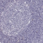 Immunohistochemical staining of human tonsil shows no positivity in lymphoid cells as expected.