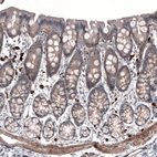 Immunohistochemical staining of rat rectum shows moderate positivity in basement membrane of glandular cells.