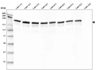 Western blot analysis of purified human recombinant Laminin-111, Laminin-121, Laminin-211, Laminin-221, Laminin-411, Laminin-421, Laminin-511, Laminin-521 and Laminin-332.