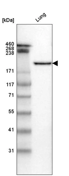 Western blot analysis in human lung tissue.