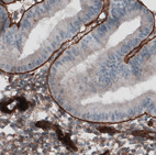 Anti-LAMC1 Antibody