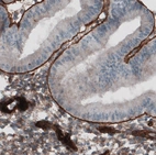 Immunohistochemical staining of human endometrium shows strong positivity in basement membrane of glandular epithelium.