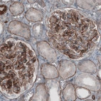 Immunohistochemical staining of human kidney shows immunoreactivity in basement membrane of renal tubules and membranous positivity in glomeruli.