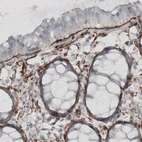 Immunohistochemical staining of human rectum shows strong positivity in basement membrane of glandular epithelium.