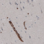 Immunohistochemical staining of human cortex shows strong positivity in endothelium.