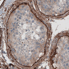 Immunohistochemical staining of human testis shows immunoreactivity in basement membrane of seminiferous tubules.