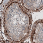 Immunohistochemical staining of human testis shows immunoreactivity in basement membrane of seminiferous tubules.