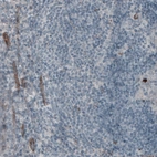 Immunohistochemical staining of human tonsil shows absence of immunoreactivity in lymphoid cells (negative control).