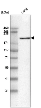 Western blot analysis in human lung tissue.