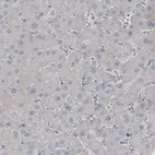Immunohistochemical staining of human liver shows absence of immunoreactivity in hepatocytes (negative control).