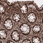 Immunohistochemical staining of human rectum shows strong cytoplasmic and nuclear positivity in glandular and connective tissue cells.