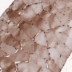 Immunohistochemical staining of human skeletal muscle shows moderate cytoplasmic and strong nuclear immunoreactivity in muscle fibers.