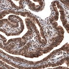 Immunohistochemical staining of human fallopian tube shows strong cytoplasmic and nuclear positivity in glandular cells.