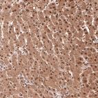 Immunohistochemical staining of human liver shows moderate to strong cytoplasmic and nuclear positivity in hepatocytes.