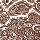 Immunohistochemical staining of human duodenum shows strong cytoplasmic and nuclear positivity in glandular cells.