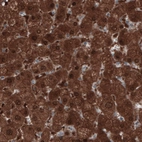 Immunohistochemical staining of human liver shows strong positivity in hepatocytes.
