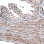 Immunohistochemical staining of human prostate shows moderate cytoplasmic immunoreactivity in smooth muscle.