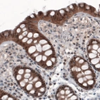 Immunohistochemical staining of human colon shows cytoplasmic positivity in glandular cells.