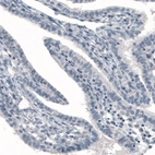 Immunohistochemical staining of human fallopian tube shows absence of immunoreactivity (negative control).
