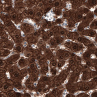 Anti-PGM1 Antibody