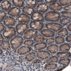 Immunohistochemical staining of human small intestine shows cytoplasmic positivity in glandular cells.