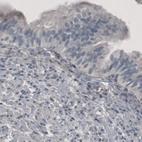 Immunohistochemical staining of human fallopian tube shows absence of immunoreactivity as expected (negative control).
