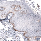 Immunohistochemical staining of human skin shows moderate positivity in the basement membrane of the basal layer of epidermal cells.