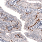 Immunohistochemical staining of human fallopian tube shows moderate to strong positivity in basement membrane of glandular cells.