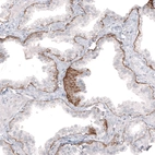 Immunohistochemical staining of human prostate shows moderate to strong positivity in basement membrane of glandular cells.