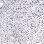 Anti-LAMB3 Antibody