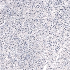 Immunohistochemical staining of human pancreas shows no positivity in glandular cells as expected.