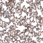 Anti-LAMB3 Antibody