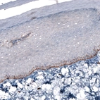 Immunohistochemical staining of rat skin shows moderate to strong positivity in basement membrane basal epidermal cells.