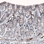 Immunohistochemical staining of rat rectum shows moderate positivity in basement membrane of glandular cells, as well as strong positivity in endothelial cells.