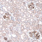 Anti-LAMB3 Antibody