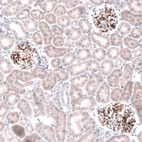 Immunohistochemical staining of rat kidney shows strong positivity in basement membrane in cells in glomeruli.