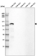 Western blot analysis of purified human recombinant Laminin-332, Laminin-421, Laminin-511, Laminin-121 and Laminin-221.