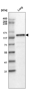 Western blot analysis in human lung tissue.