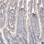 Immunohistochemical staining of human duodenum shows moderate positivity in basement membrane in glandular cells.