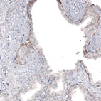 Immunohistochemical staining of human prostate shows moderate positivity in basement membrane in glandular cells.