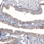 Anti-LAMB3 Antibody