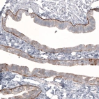 Immunohistochemical staining of human fallopian tube shows strong positivity in basement membrane in glandular cells.