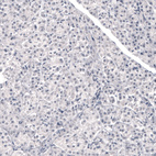 Anti-LAMB3 Antibody