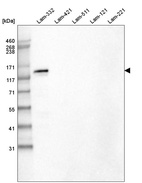 Western blot analysis of purified human recombinant Laminin-332, Laminin-421, Laminin-511, Laminin-121 and Laminin-221.