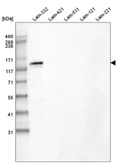 Western blot analysis of purified human recombinant Laminin-332, Laminin-421, Laminin-511, Laminin-121 and Laminin-221.