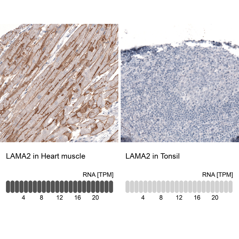 Anti-LAMA2 Antibody