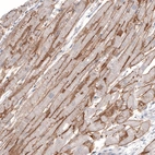 Immunohistochemical staining of human heart muscle shows strong membranous positivity in cardiomyocytes.