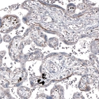 Immunohistochemical staining of human placenta shows moderate positivity in basement membrane of trophoblastic cells.