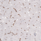 Immunohistochemical staining of human cerebral cortex shows moderate positivity in blood vessels.